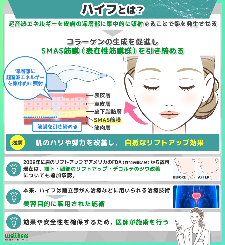 ハイフとは