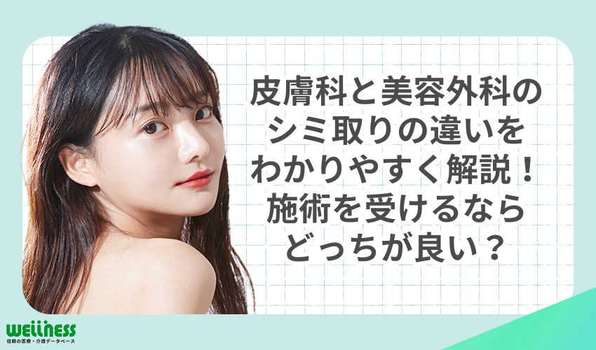 皮膚科と美容外科のシミ取りの違いをわかりやすく解説！施術を受けるならどっちが良い？