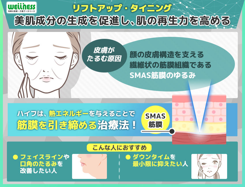 リフトアップ・タイニング