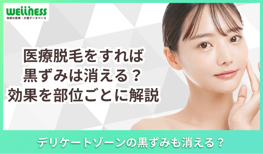 医療脱毛をすれば黒ずみは消える？効果を部位ごとに解説
