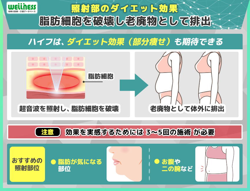 照射部のシェイプアップ効果