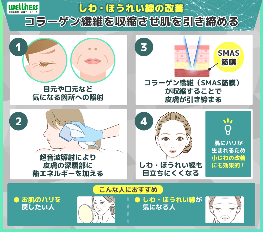 しわ・ほうれい線の改善